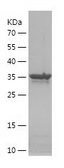    ARPC2 / Recombinant Human ARPC2