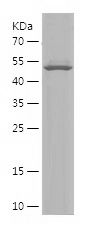    ADAMTS12 / Recombinant Human ADAMTS12