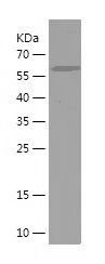 Recombinant Mouse  CTGF