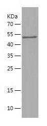    CPEB1 / Recombinant Human CPEB1