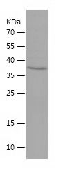    APLP1 / Recombinant Human APLP1