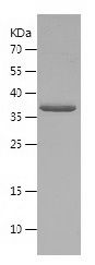    AKAP7 / Recombinant Human AKAP7