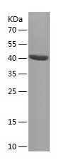    ARK5 / Recombinant Human ARK5