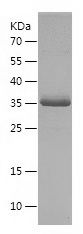    PDCD5 / Recombinant Human PDCD5