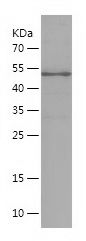    ANTXR2 / Recombinant Human ANTXR2