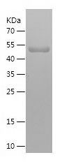    AKAP12 / Recombinant Human AKAP12