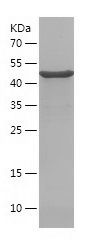    ARHGDIB / Recombinant Human ARHGDIB