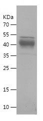    Lumican / Recombinant Human Lumican