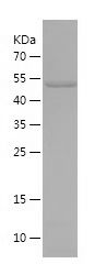    VPS4B / Recombinant Human VPS4B