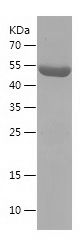    STX11 / Recombinant Human STX11