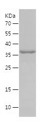    OMA1 / Recombinant Human OMA1