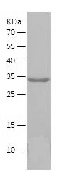    HOPX / Recombinant Human HOPX