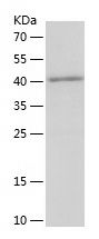    CKLFSF6 / Recombinant Human CKLFSF6